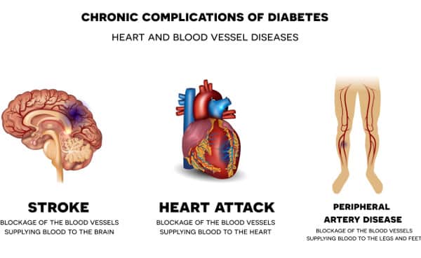 heart attack heart disease blood vessel stroke super brain pill smart pill potential focus memory nootropics brain supplement sleepy driving fall asleep driving gym workout